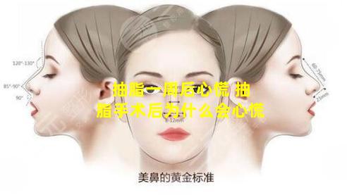 抽脂一周后心慌 抽脂手术后为什么会心慌